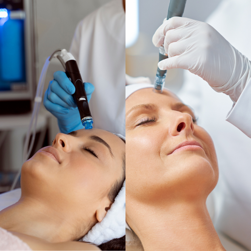Pack Hydrafacial + Microneedling